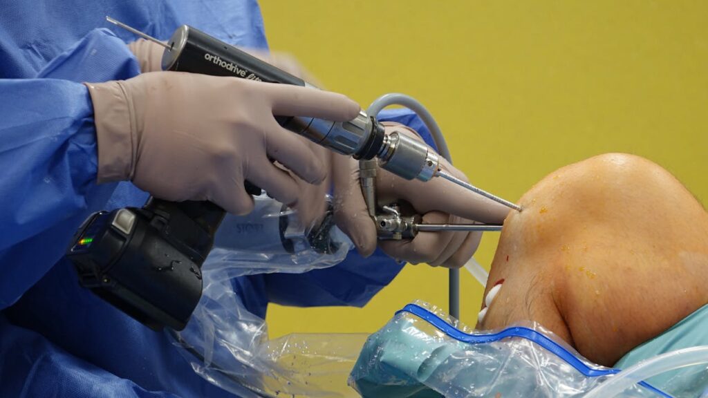 Tratamento: do conservador à cirurgia